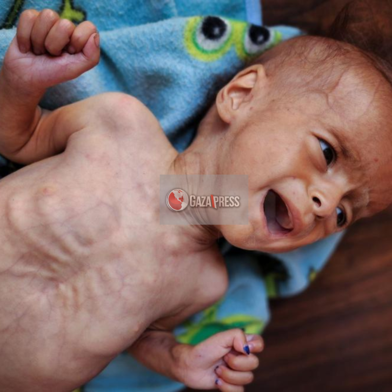 "جمعة كسر الحصار".. دعوات لمسيرات شعبية بالضفة رفضًا لتجويع غزة